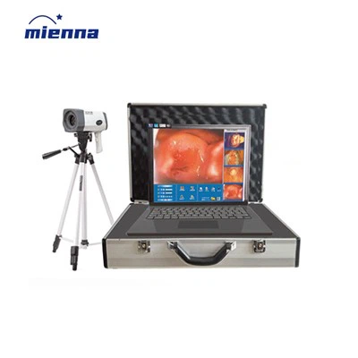 กล้องส่องตรวจทางนรีเวชแบบดิจิตอลอิเล็กทรอนิกส์